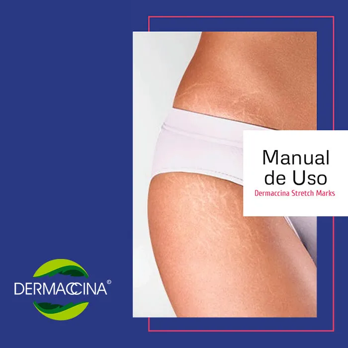 Dermaccina Estrías Tratamiento Avanzado